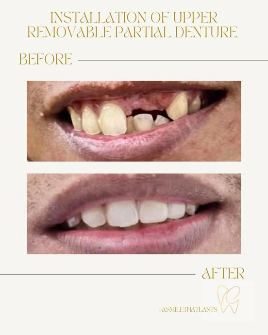 teeth